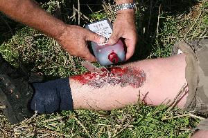 Bild: Das DRK beim Vorbereiten der Übung: Diese Verletzung sieht täuschend echt aus, ist jedoch nur geschminkt